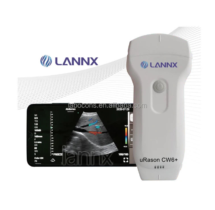LANNX uRason CW6+ Customized Medical Wireless Convex Linear array probe ultrasound portable wifi ultrasound probe scanner system
