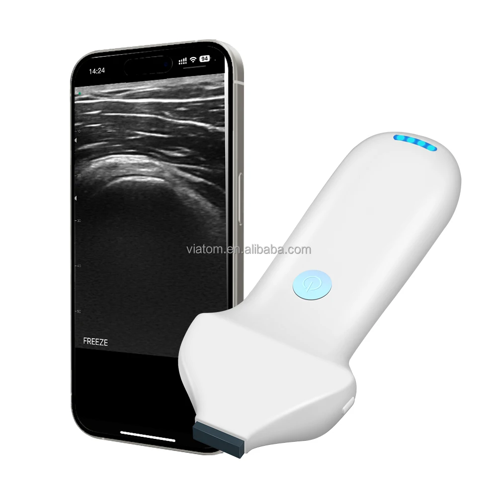 Viatom 192 Elements Handheld Ultrasound Beauty Injections High Frequency Linear Portable 18/24Mhz Wireless Ultrasound Probes