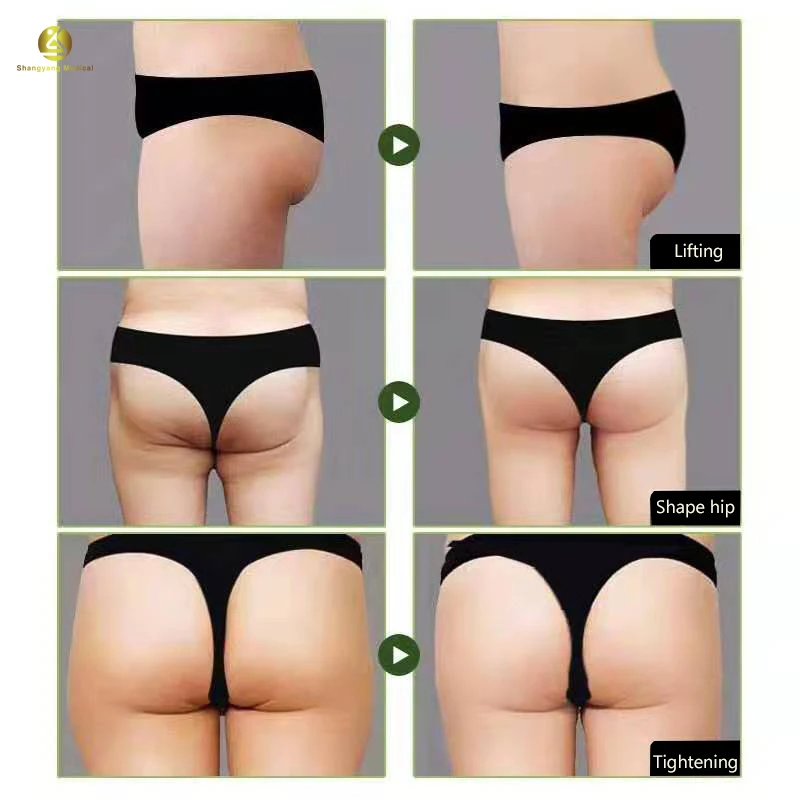 
Макролан с гиалуроновой кислотой, 10 мл, 20 мл, 50 мл, 100 мл, Филлер для ягодиц, инъекция ягодиц 