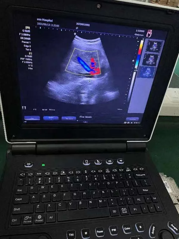 ONETECH C55 12.1 inch 2D 3D ultrasound Notebook doppler ecog Portable ultrasound machine
