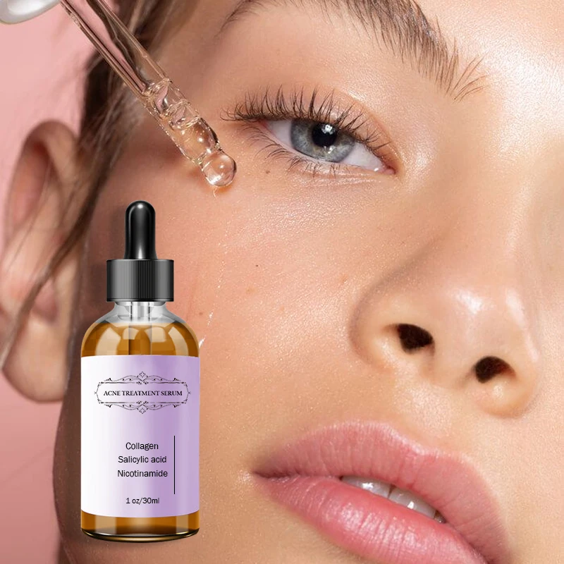 Oem Natural Organic 8% Aha Serum Face Deep Peeling Exfoliating Solution Whitening Skin Facial Serum Private Label