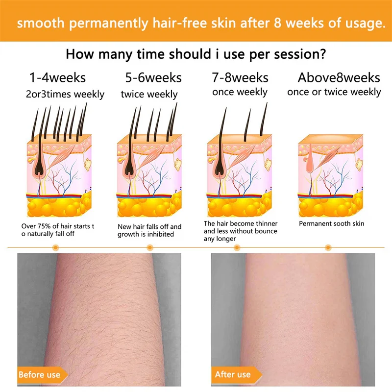 Portable ipl hair removal home, High efficiency hair removal,permanent Mini epilator ipl Laser hair removal device