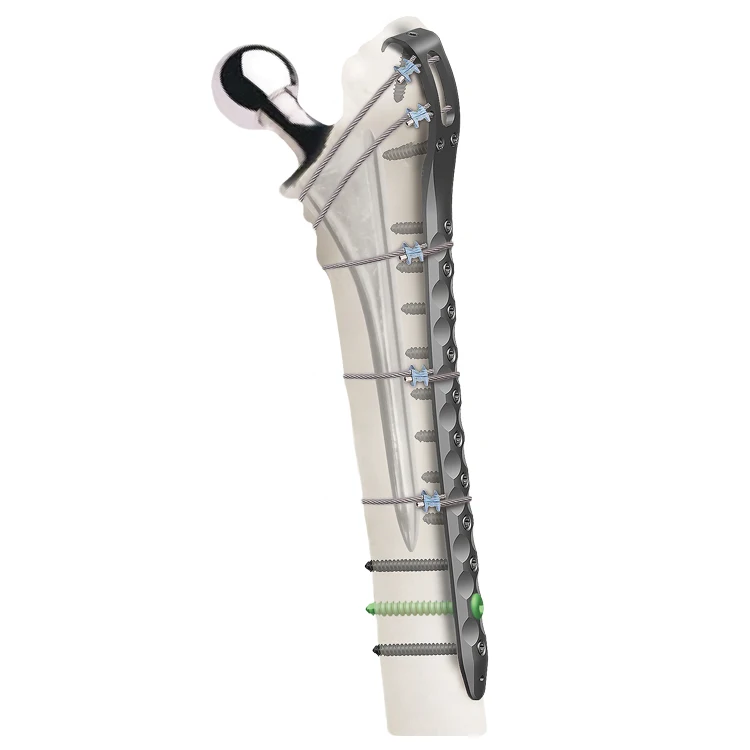 Orthopedic Trauma Implants - Titanium Binding System