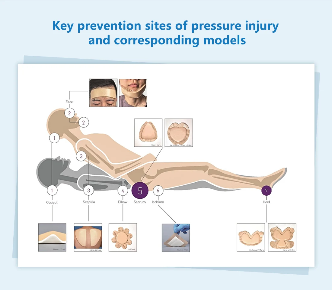 BLUENJOY Top Sale Silicone Foam Dressing in Hospital for Chronic Ulcer Wound Care Dressings