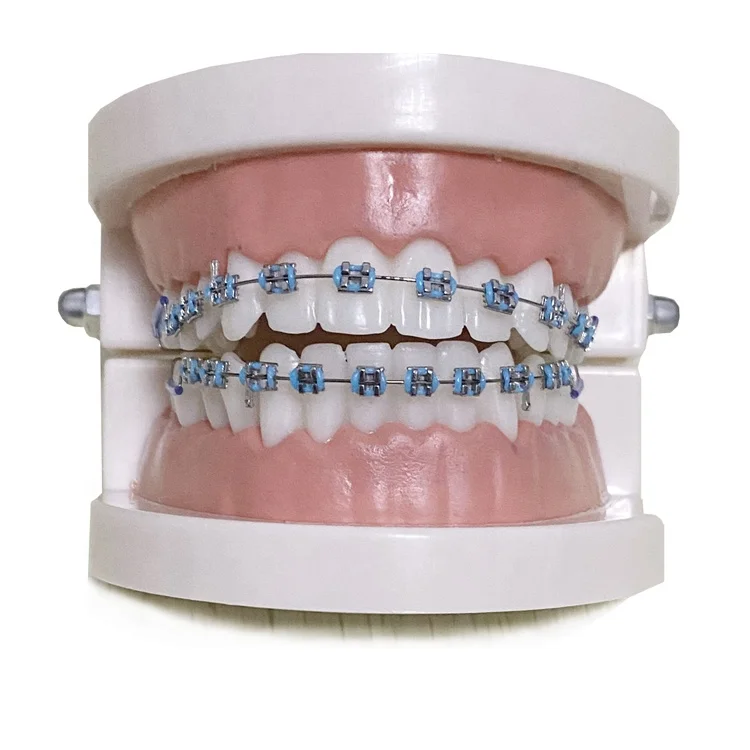 Dental fashion fake braces for teeth false teeth brace orthodont bracket colorful crowns trending products 2024 new arrivals