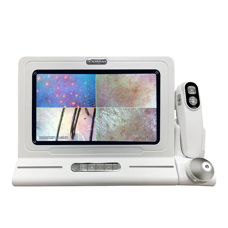 Handheld High Quality HD Hair Follicles Scalp Scanner Detector Hair Analyzer / Skin And Scalp Hair Analysis Machine