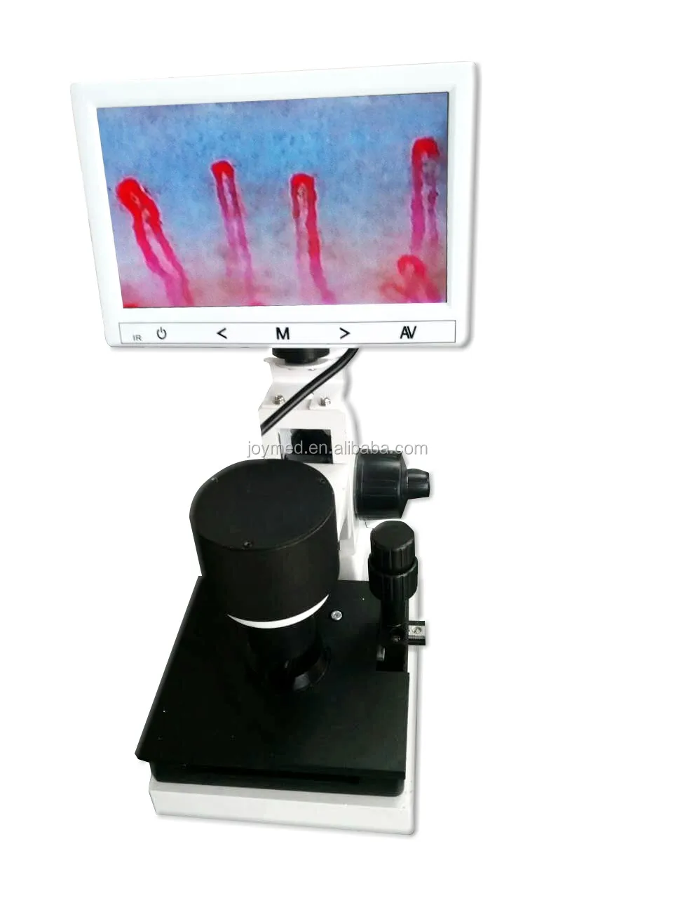 JOYMED JM-1004C Noninvasive capillaroscope nail bed capillaroscopy test system with analysis software