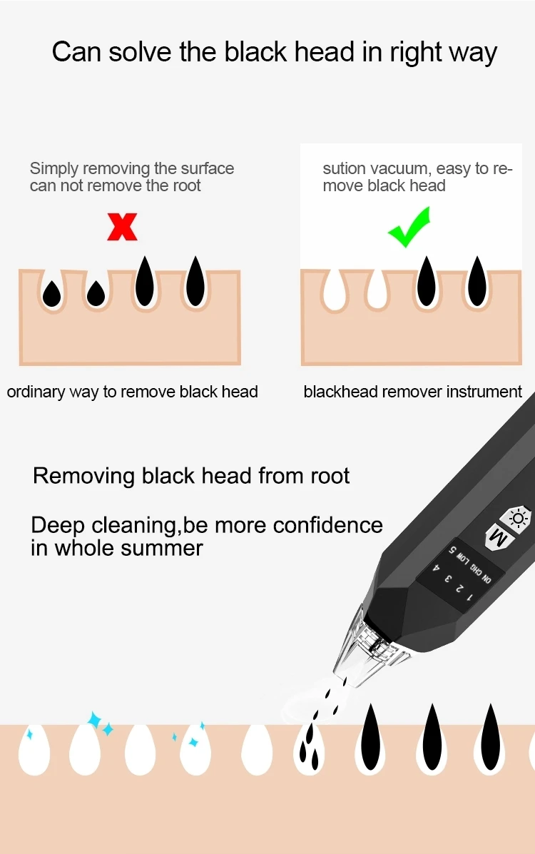 Удаление черных точек и прыщей вакуумное всасывание удаление с подогревом глубокий очиститель лица