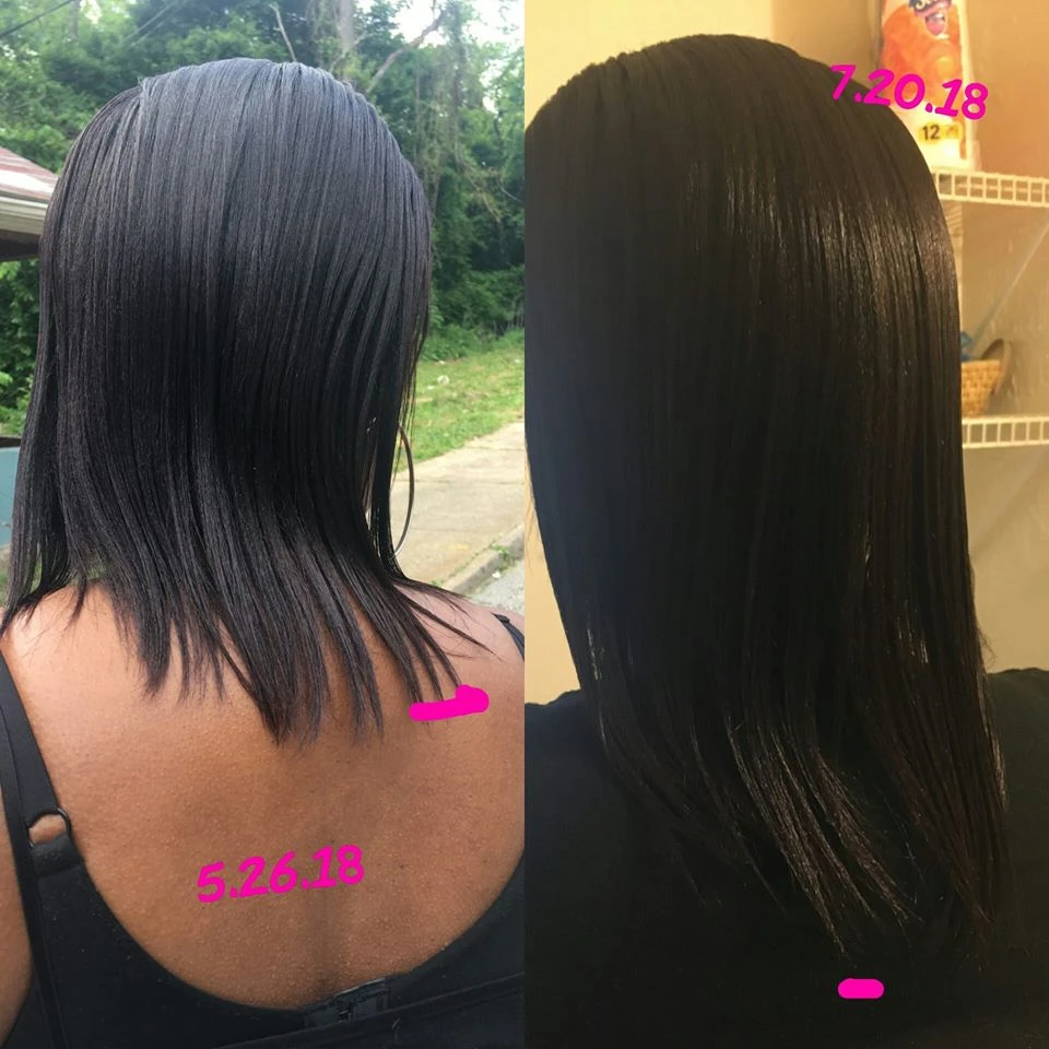 Private Label 100% Natural Herbal Organic Wholesale Scalp Elixirs Care Loss Treatment Rosemary Hair Growth Oil Serum For Hair