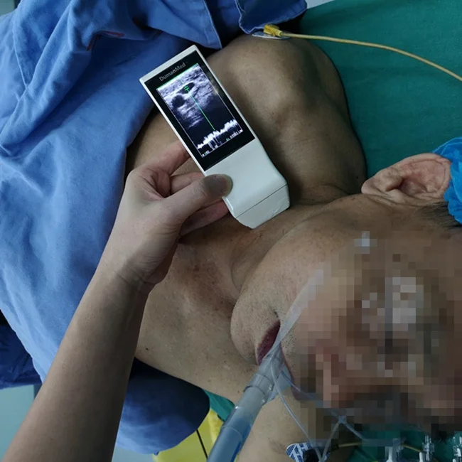 3 Inch Waterproof Handhlld Wireless Color Doppler Ultrasound Scanner WiFi Linear Probe