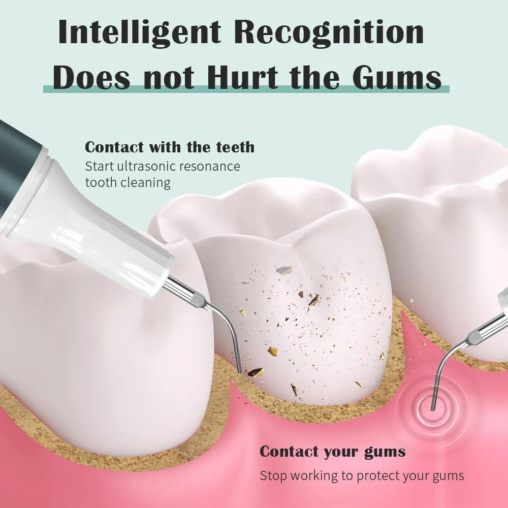 Electric Household Calculus Remover Portable Tooth Cleaner Ultrasonic Dental Scaler with LED spotlight