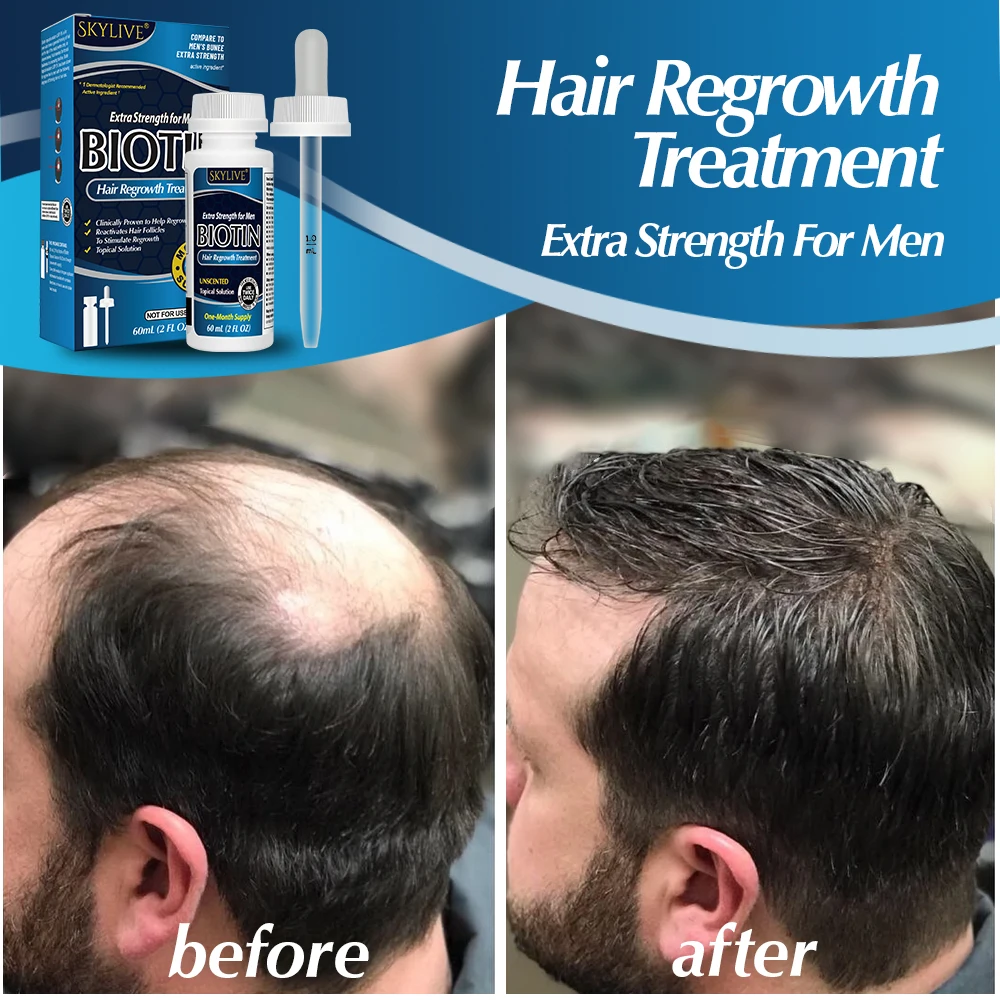 Biotin Hair Growth Serum For Anti Loss Essential Oil Products Fast Treatment Prevent Thinning Dry Frizzy Repair Private Label