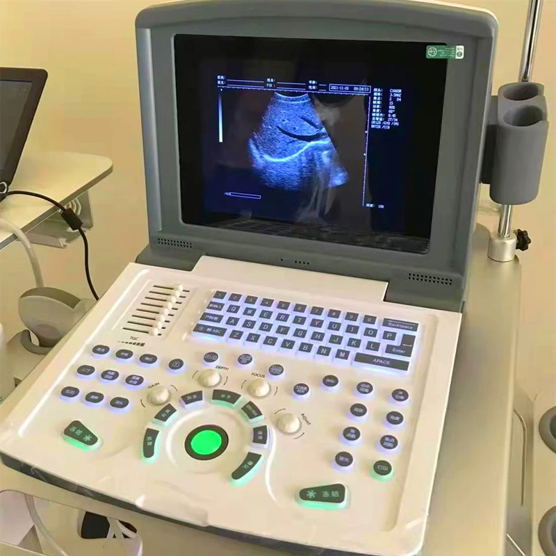 Cheap Portable Medical Ultrasound Scanner