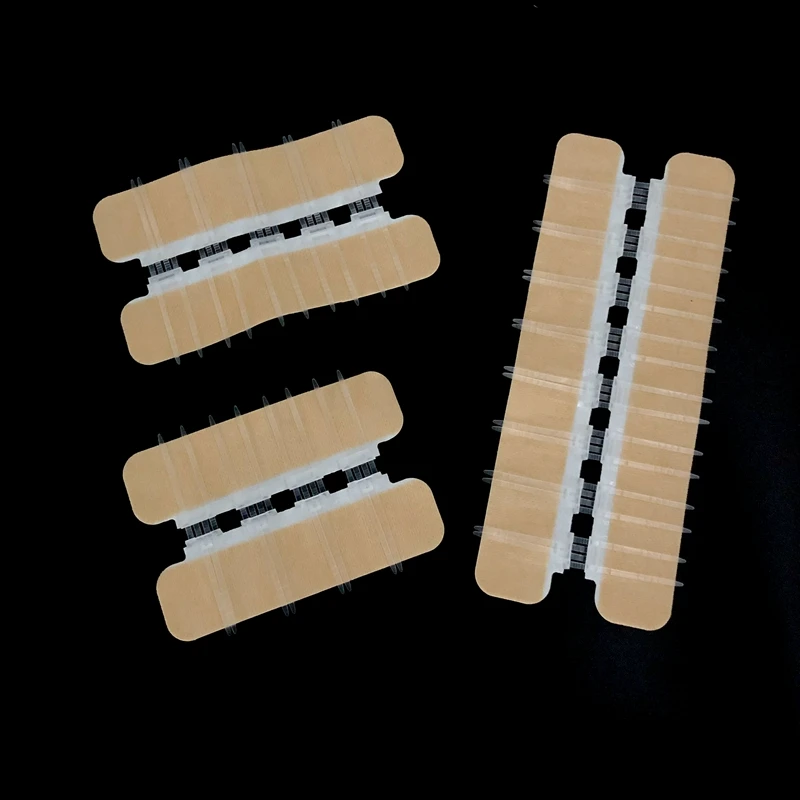 
Devices for wound closure zip skin closure zipstitch 