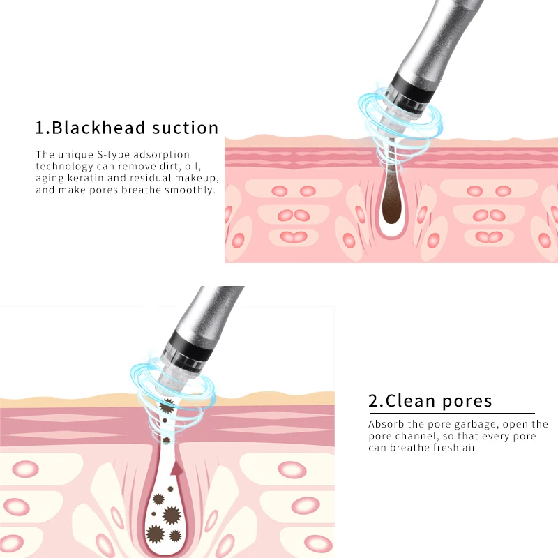 2023 Hot Selling new products  unique portable blackhead remover vacuum pore cleaner facial extractor tool