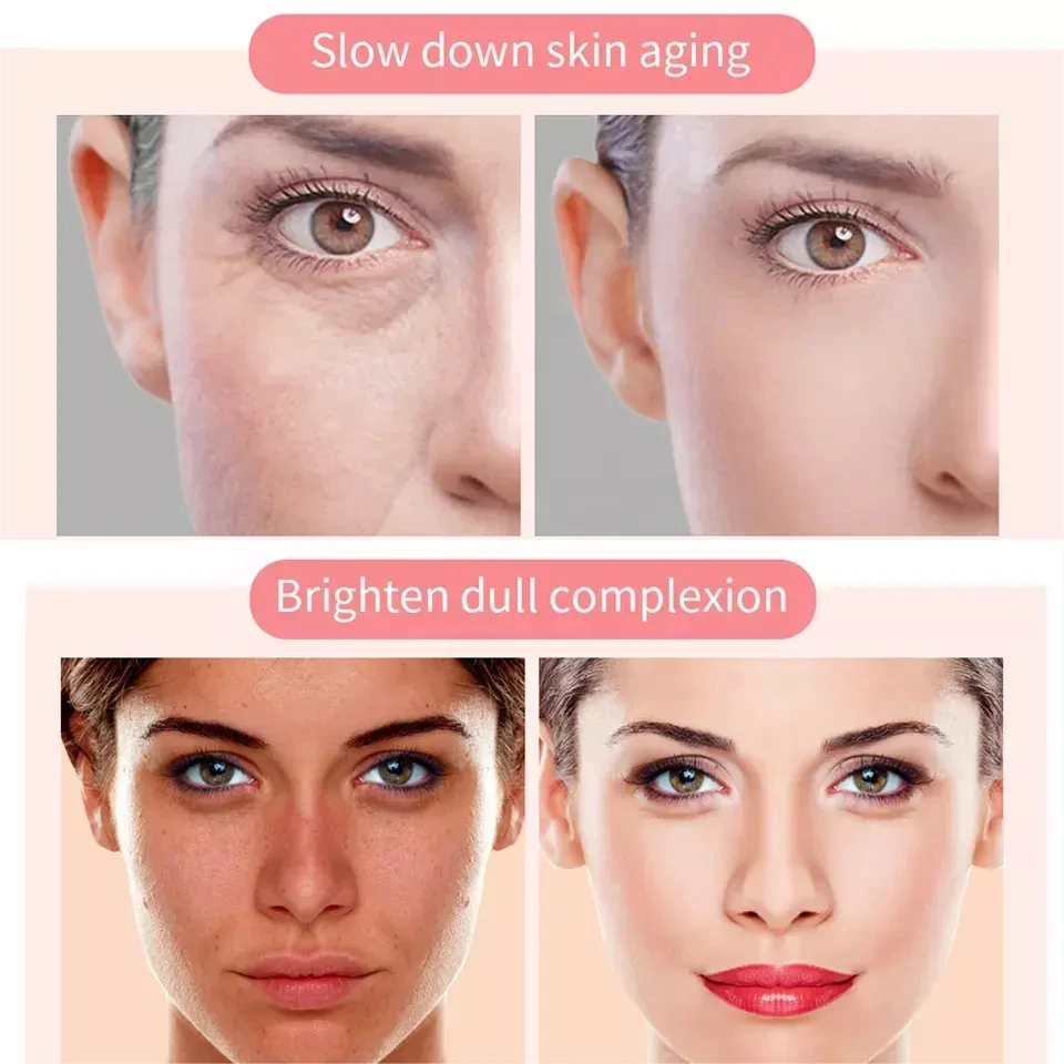 Strong Effective Skin Lightening Reduce Redness Burn Face Face Whitening Freckle Cream Remove Fade Dark Cream