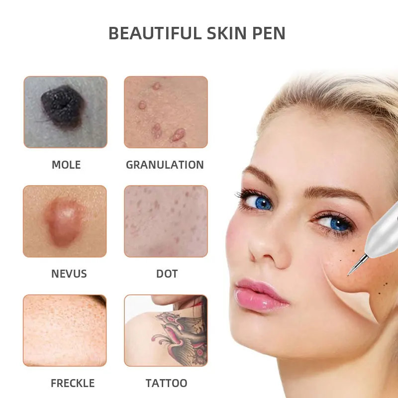 Cheap Portable Cryopen/Skin Sopt Mole Removal Machine Cryo Pen
