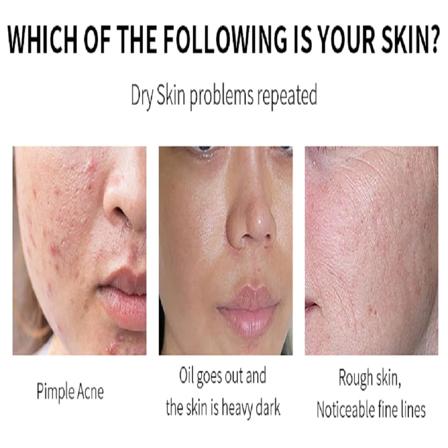BLIW OEM Private Label Natural Soft Anti-Wrinkle Whitening AHA BHA Radiant Glow Exfoliating Peeling Face Serum