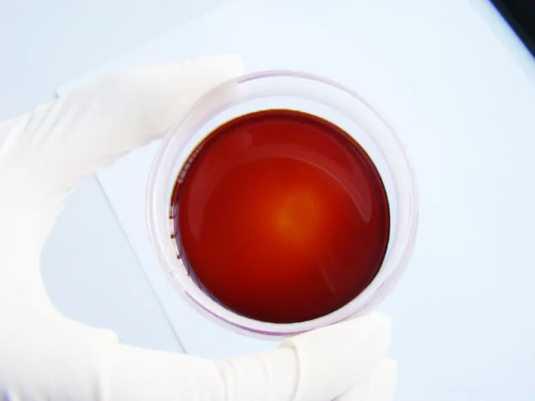 High Quality Astaxanthin Supplement 5% 10% Natural Haematococcus Pluvialis Extract CAS 472-61-7 Astaxanthin oil