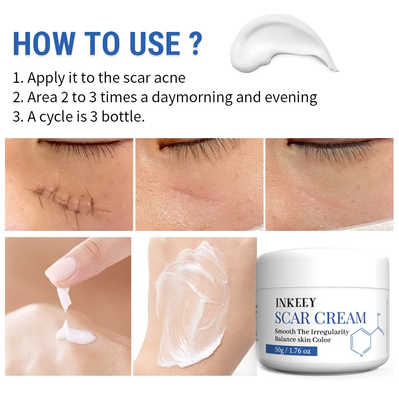 Scar Removal Cream ForSkin Care Scar Removal  Butter  whitening cream