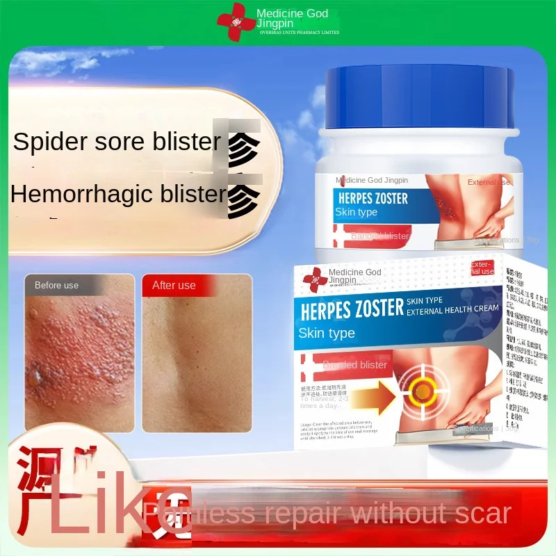 Drug God Jingpin Strip Blister Diagnosis Ointment Factory Direct Antipruritic Snake Wrapping Waist Snake Chinese Plaster