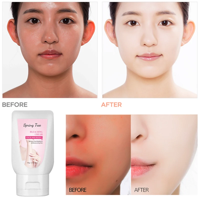 Private label natural formula organic dark skin bleaching whitening skin cream