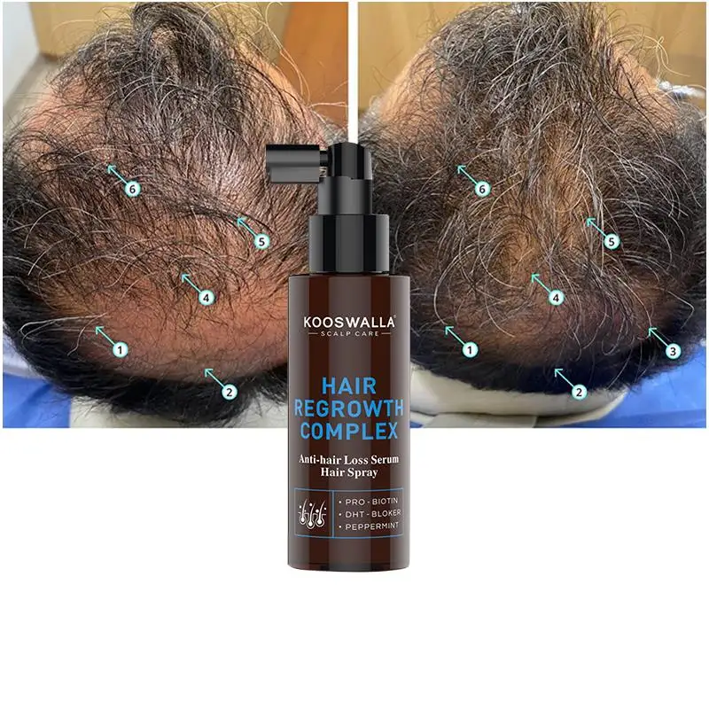 Wholesale Africa Black Man Use Organic And Natural Hair Growth Spray Anti Hair Loss Spray