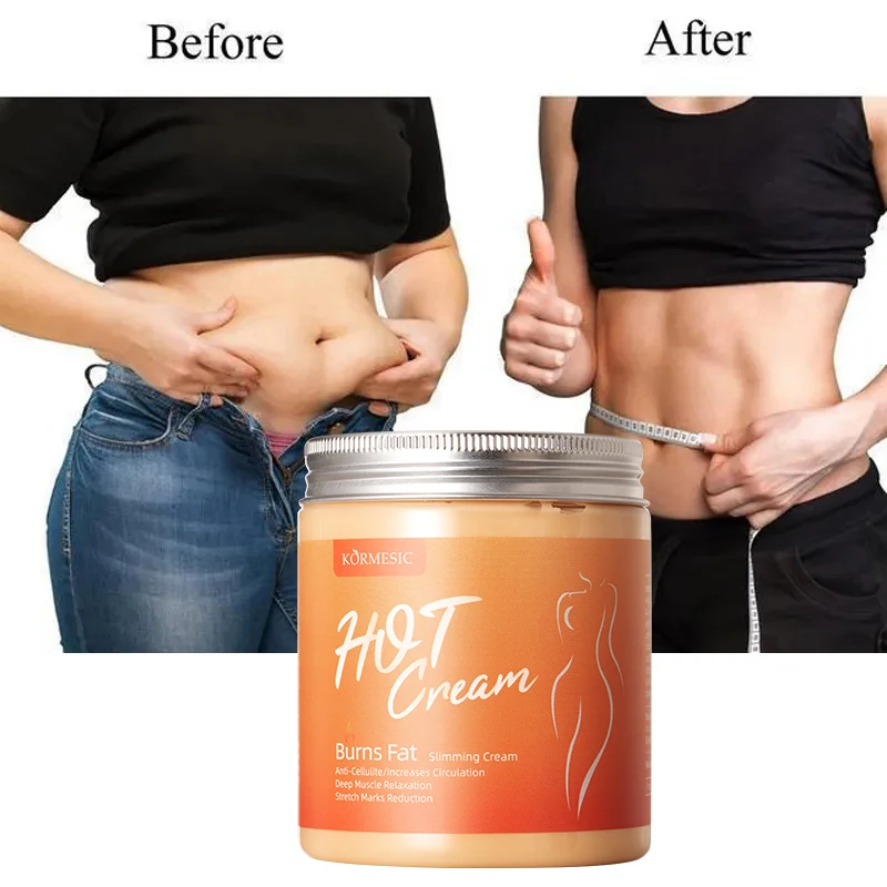 OEM KORMESIC Private Weight Loss Fat Burning Slimming Hot Cream