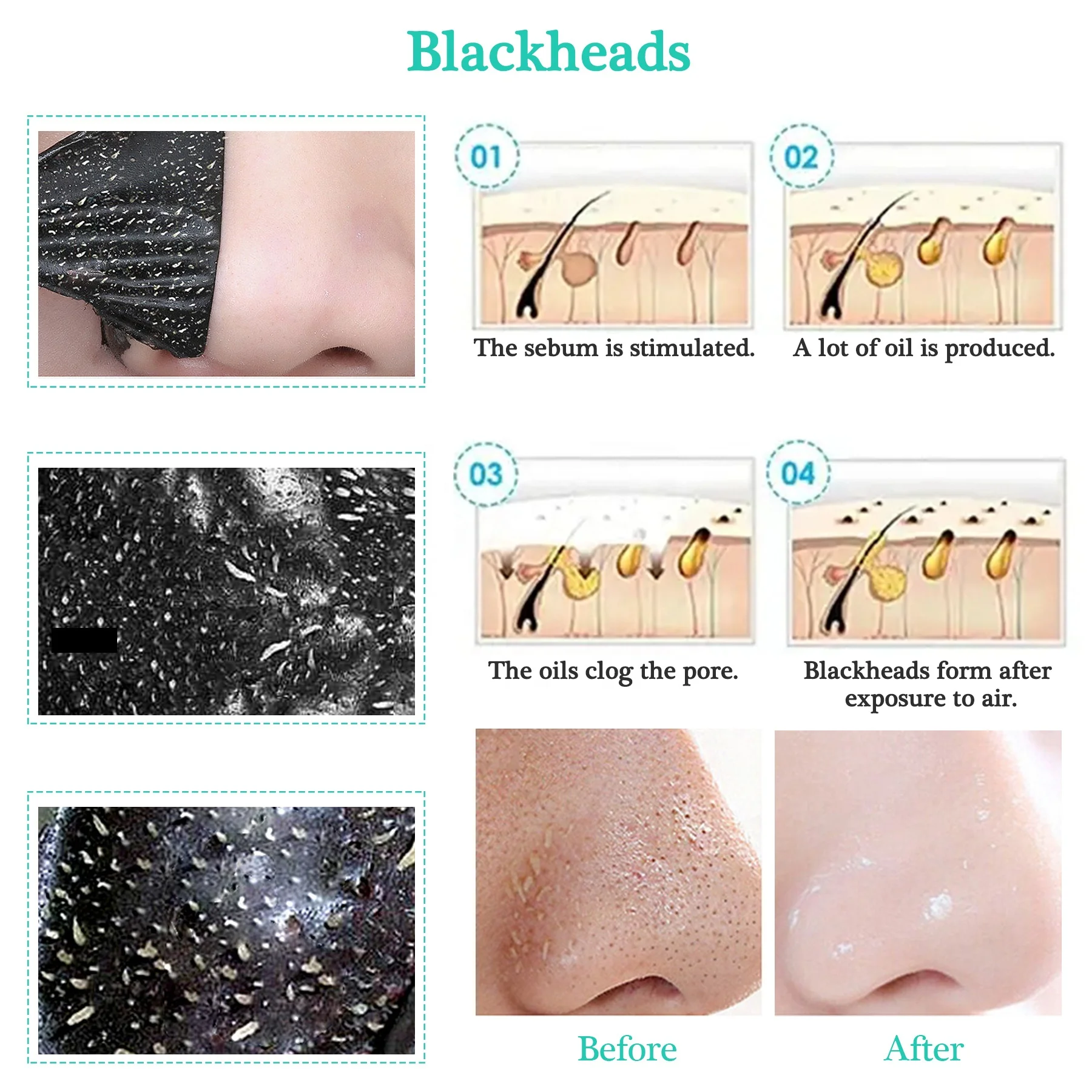 Private Label Bamboo Activated Charcoal Peel-Off T-zone Nose Mask Natural Charcoal Mask Black Head Mask Removal