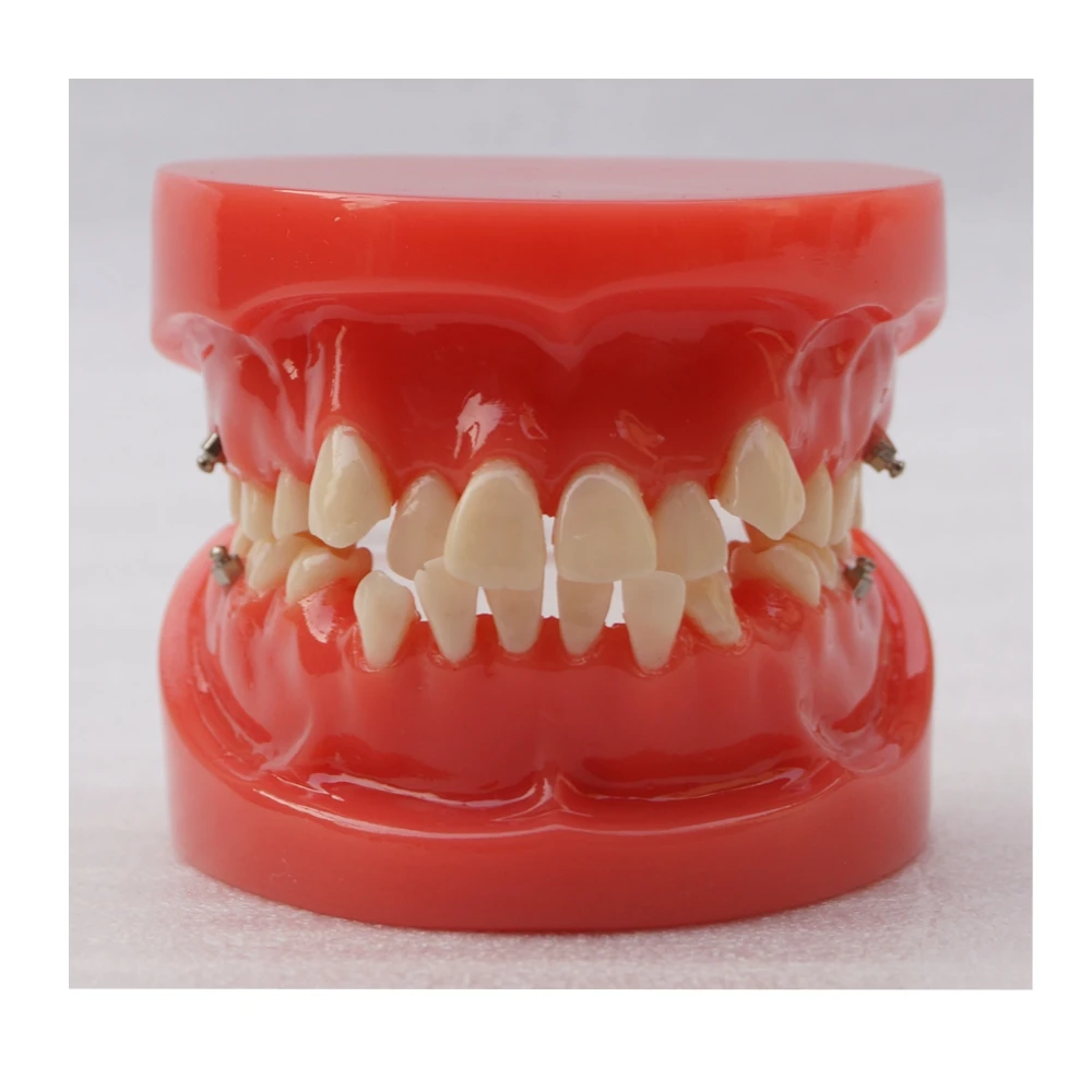 Dental Orthodontic Teeth Study Model Typodont Teeth Model 24Teeth