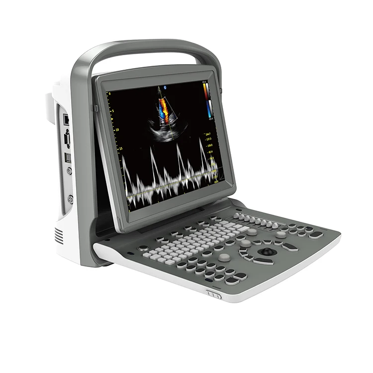 Chison ECO6 Promotion of the cheapest price Full digital ultrasound excellent 3D 4D color Doppler  ultrasound