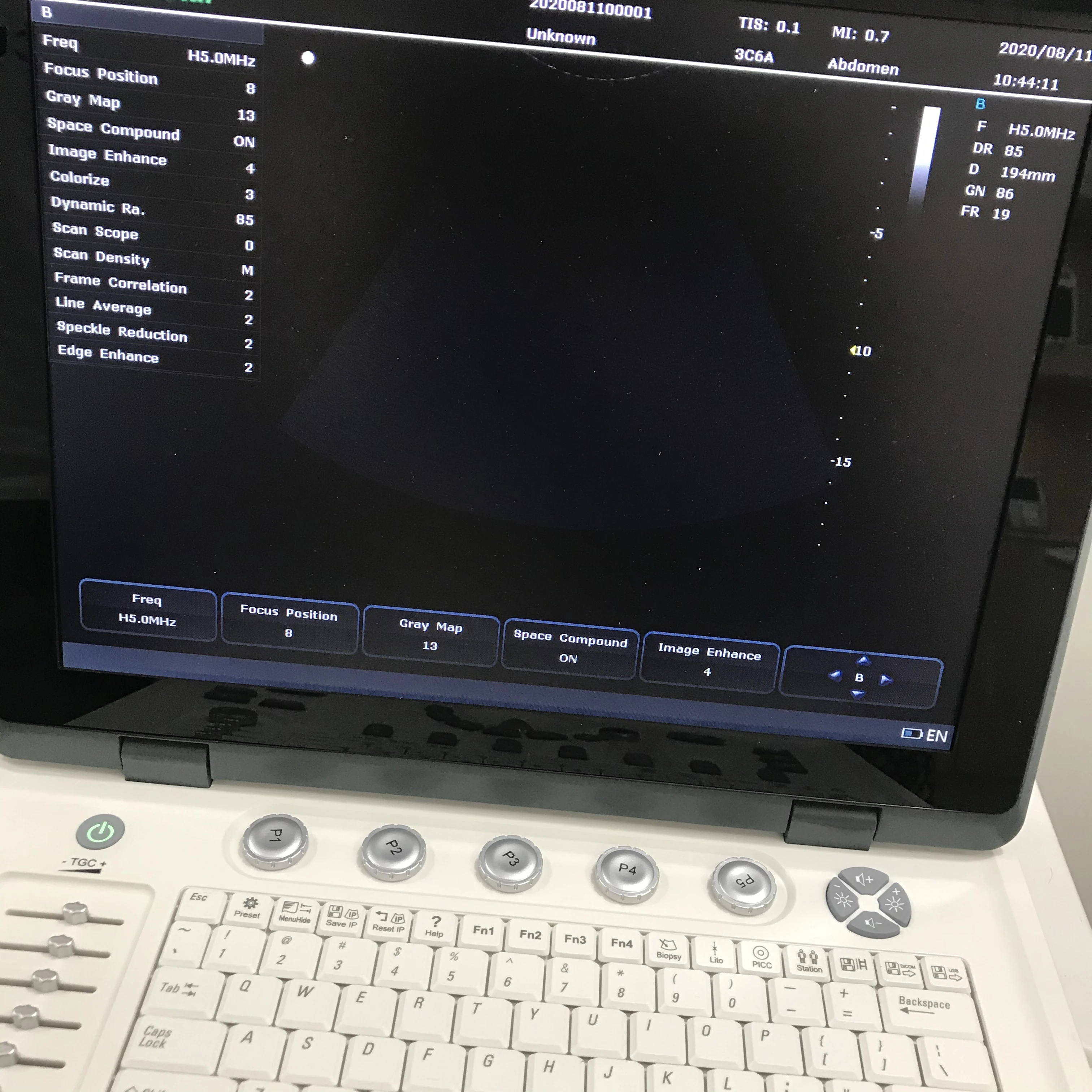 High quality machine color doppler ultrasound ultrasound machine color doppler ultrasound color doppler laptop