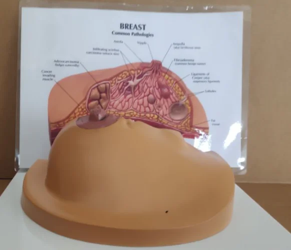 Pathological models of the breast on the anatomy of medical diseases and cancers Models of the female breast