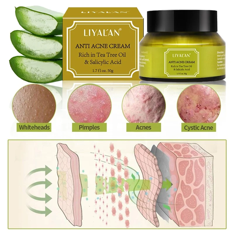 Private Label Tea Tree Oil Salicylic Acid Skin Repair Lighten Anti Acne Scar Pimple Shrink Pores Face Cream