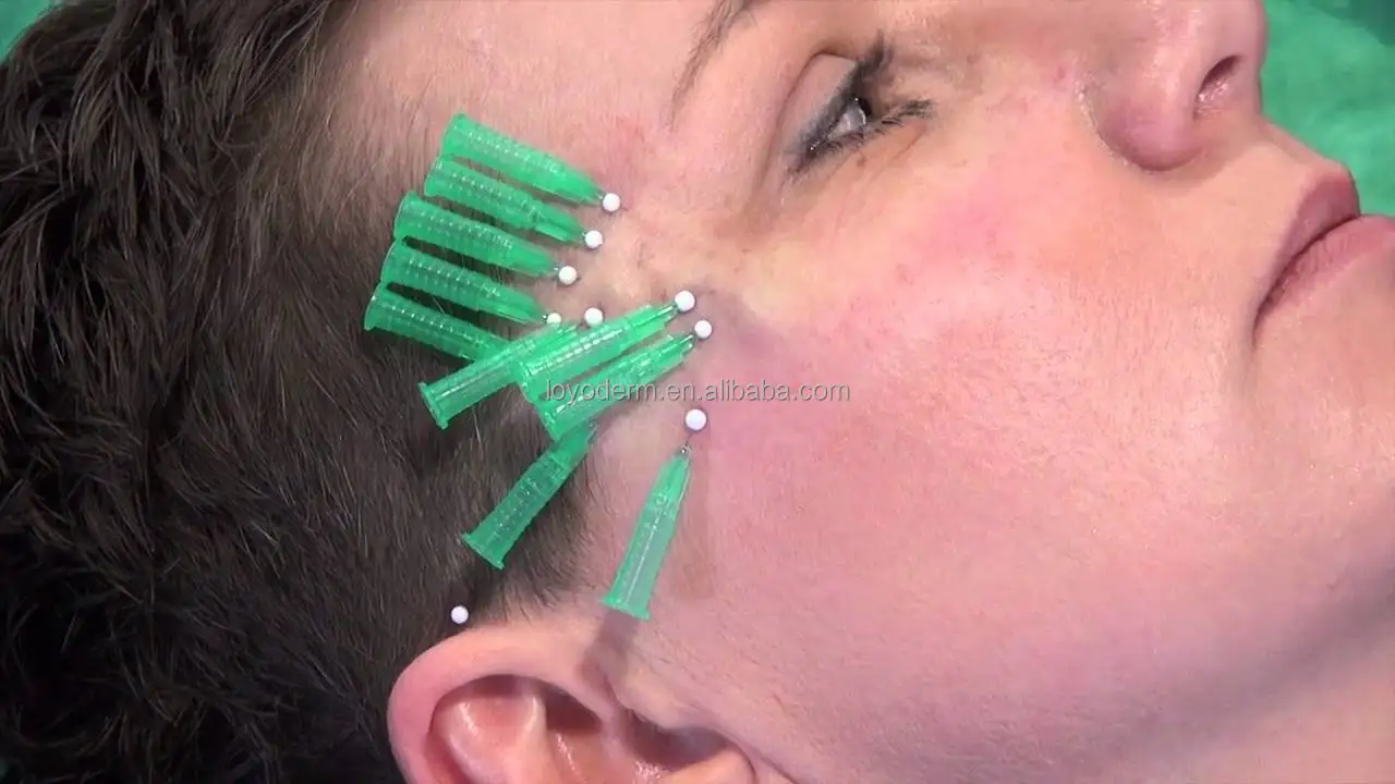 Beauty products polypropylene 4d cog pdo thread 21G 60mm lift foxeye stong pdo thread