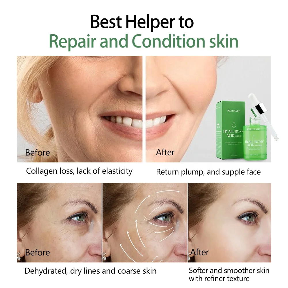 Korean Cosmetics Face Antioxidant Lifting Face Serum Moisturizing Hyaluronic Acid Serum