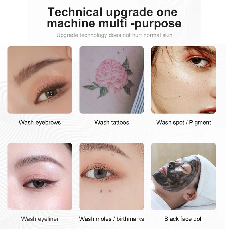 Manufacturer Q Switched Nd Yag Laser Tattoo Removal Beauty Machine Blood Vessels Remova Nd: Yag Laser Erasing Laser Tattoos