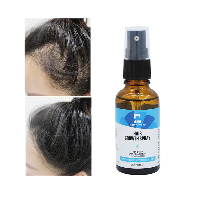 OEM Free Sample Strengthen Hair Follicles New Men Hair Grow Spray Herbal Extract Hair Growth Spray Effective 30ml