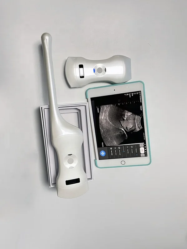192 elements Color Doppler Ultrasound Wireless Ultrasound Scanner Wireless Double Heads 3 in 1
