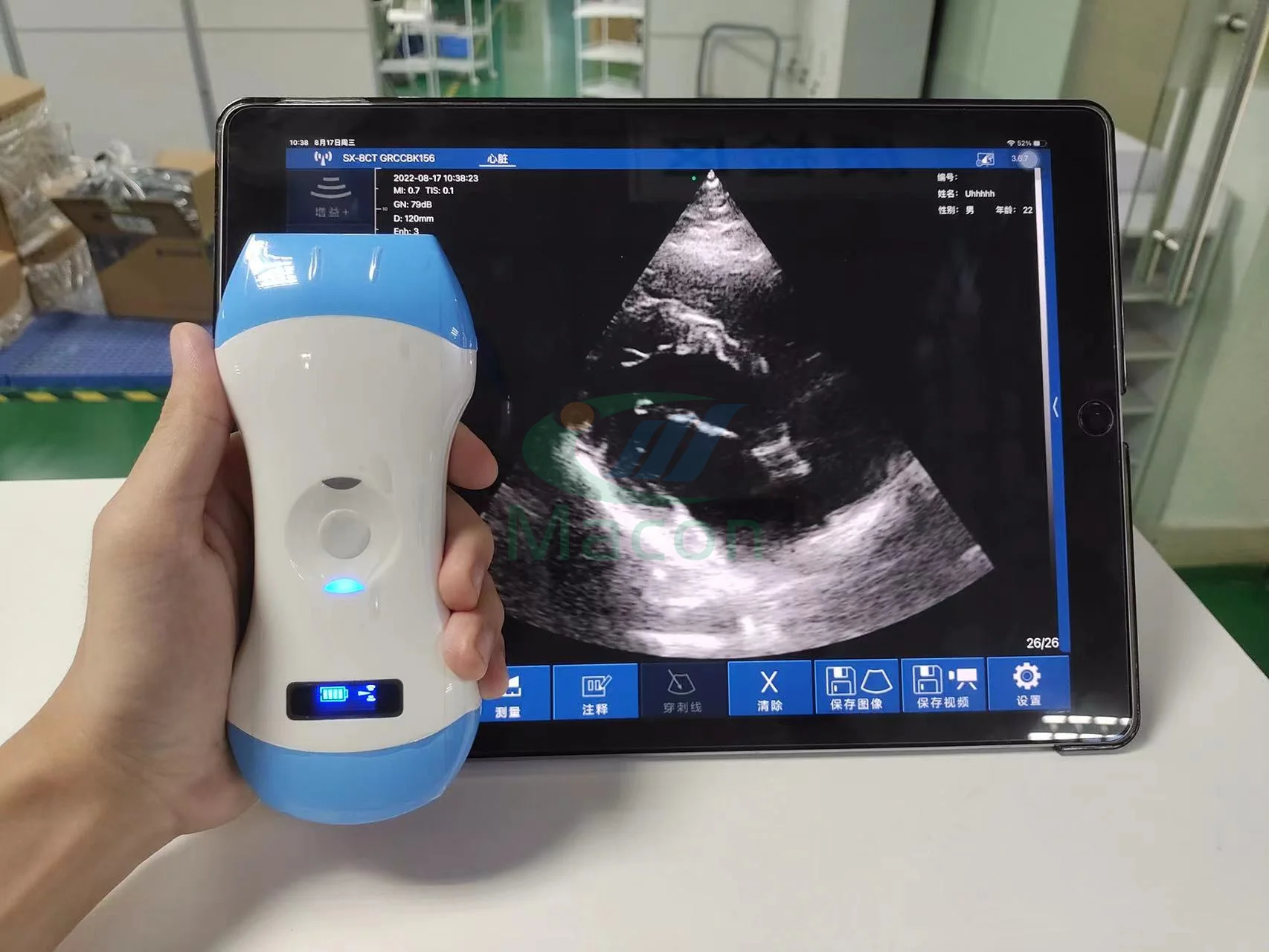 MC25 3 arrays 5 imaging modes 3 in 1 wireless ultrasound probe scanner for full body diagnostic imaging