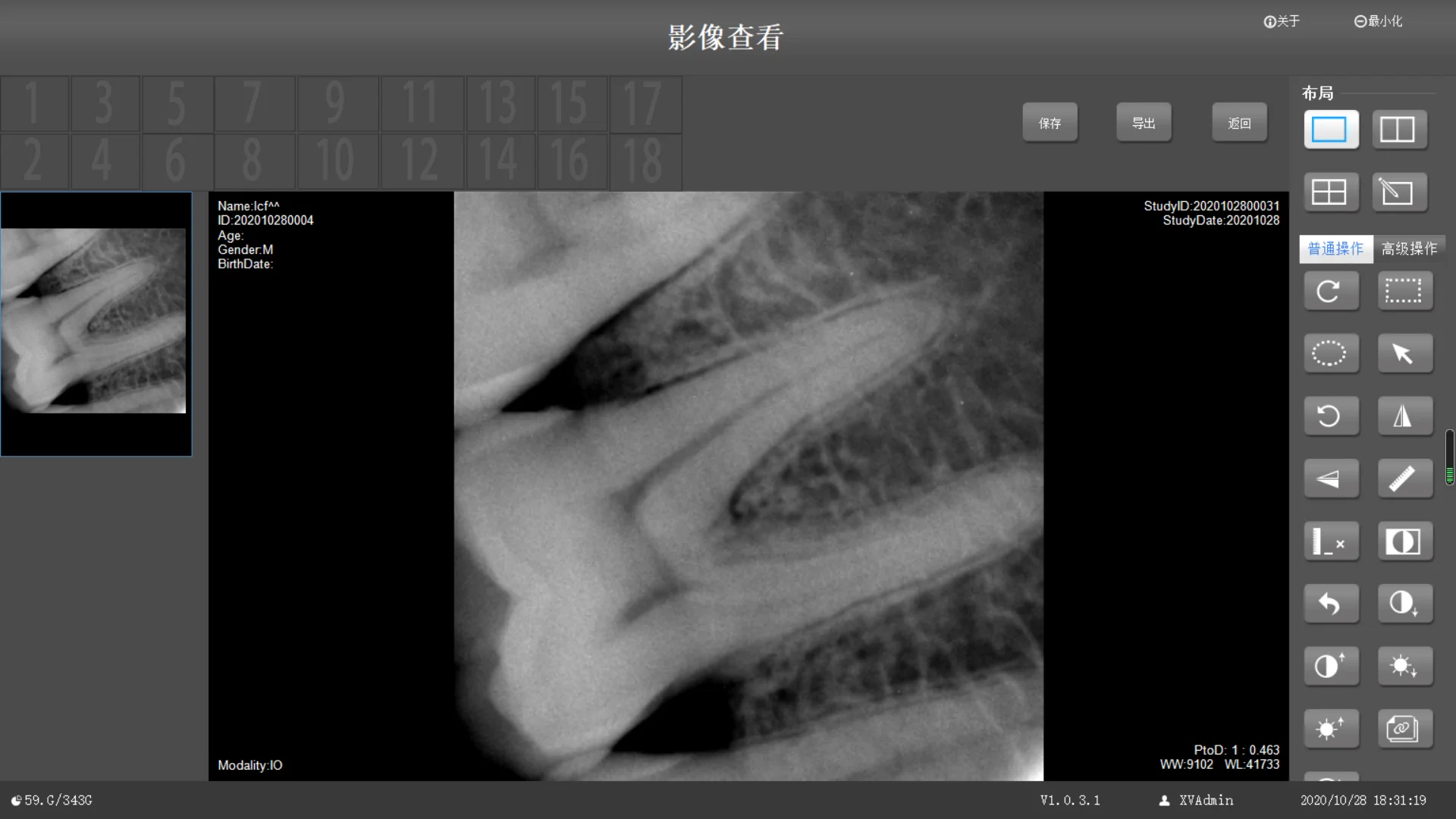 Customized dental sensor rvg dental digital intraoral X-ray sensor