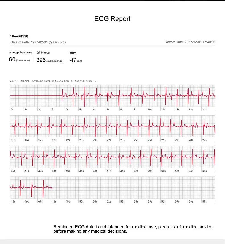 E88 ECG smart watch_05.jpg