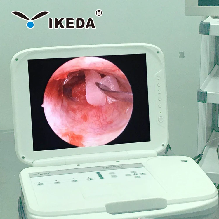 Portable ent surgery endoscope electronic medical endoscope supplier