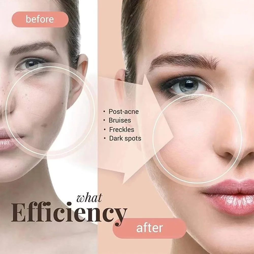 Травяной экстракт против пятен отбеливающий ночной крем для удаления веснушек темных лица сделано в Японии