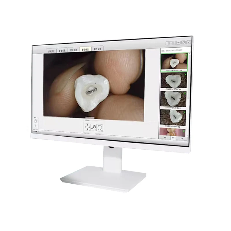 LK-I35 Dental Endoscope Camera System Intra Oral Camera Price for Dental Clinic