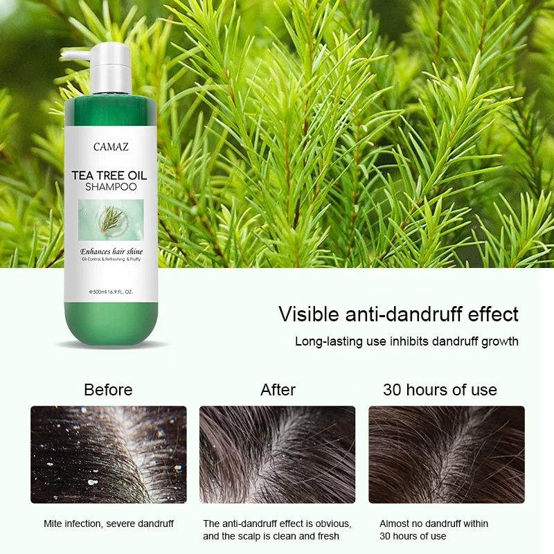 CAMAZ 500ml Sulfate Free Tea Tree Oil Hair Shampoo and Conditioner Set for Dry Damaged Hair and Scalp Care