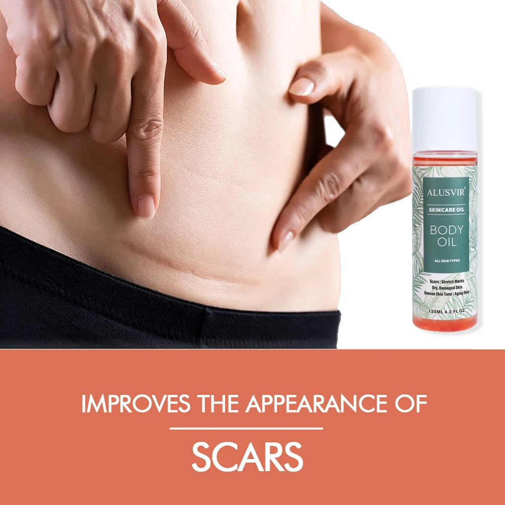 In Stock Korean Beauty Body Stretch Mark Removal Oil Body Care Scar Remover Pregnancy Anti Aging Skin Whitening Massage Oil