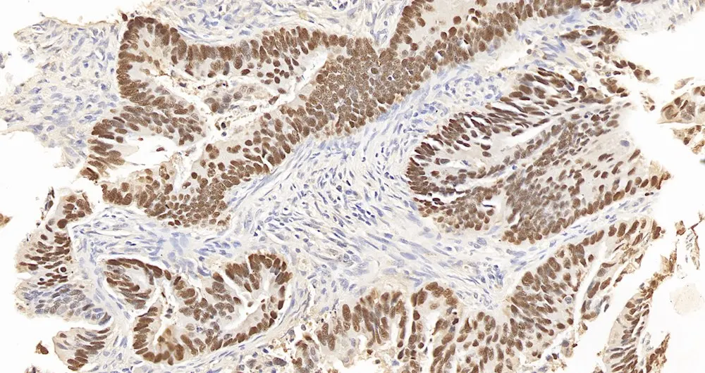Primary Antibodies Polyclonal Antibody Anti-p53 Rabbit biotechnology laboratory