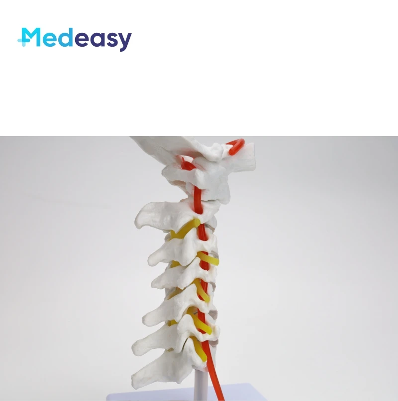Human Cervical Vertebra Model with Carotid Artery, Cervical Spine Column Model