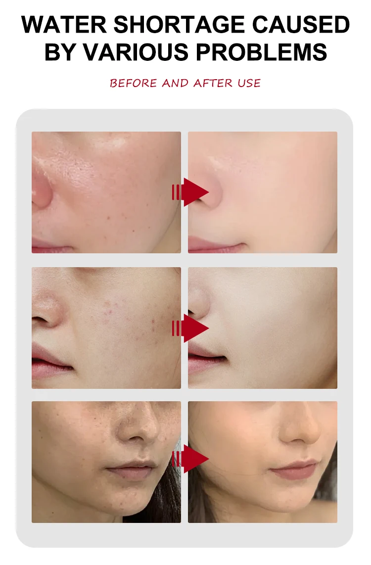 Factory cosmetic Face Care Korea Aloe Serum Beauty OEM Facial C Brightening Serum With Vitamin C Hyaluronic Acid Serum For Face